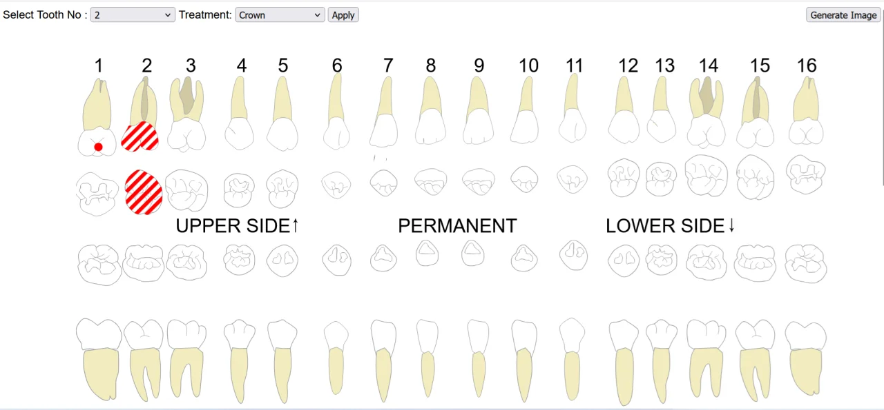 Dental Implants Tool — screenshot 1